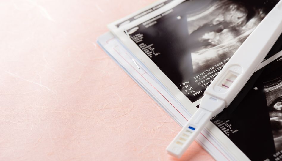 Dos ecografías junto a una prueba de embarazo
